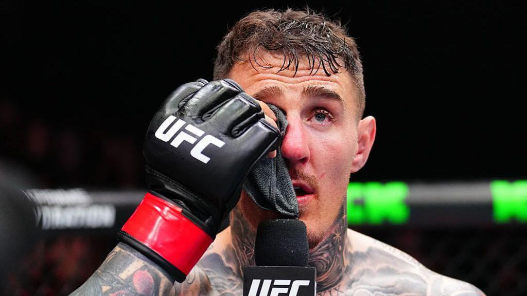 Aspinall requires further tests on eye injury in UK